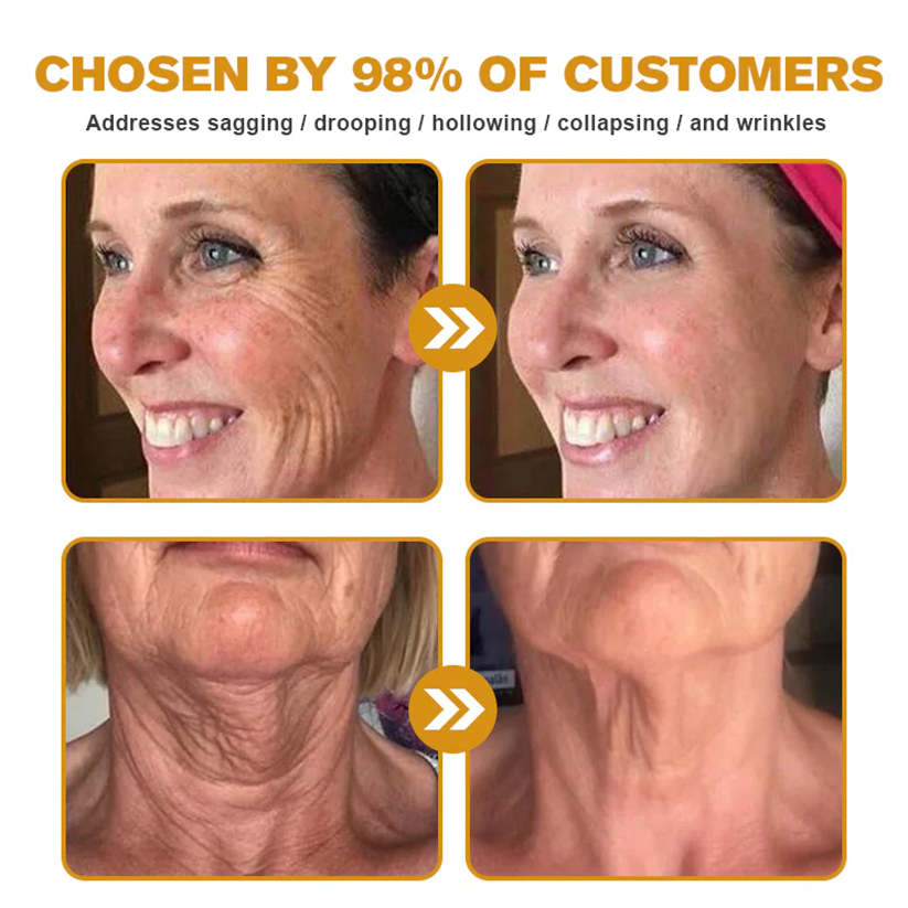 🔥Limited Time 60% OFF🔥🐝FDA Approved: Apithera™  Bee Venom Comprehensive Cream 🐝(Suitable for all ages & TGA recommends)