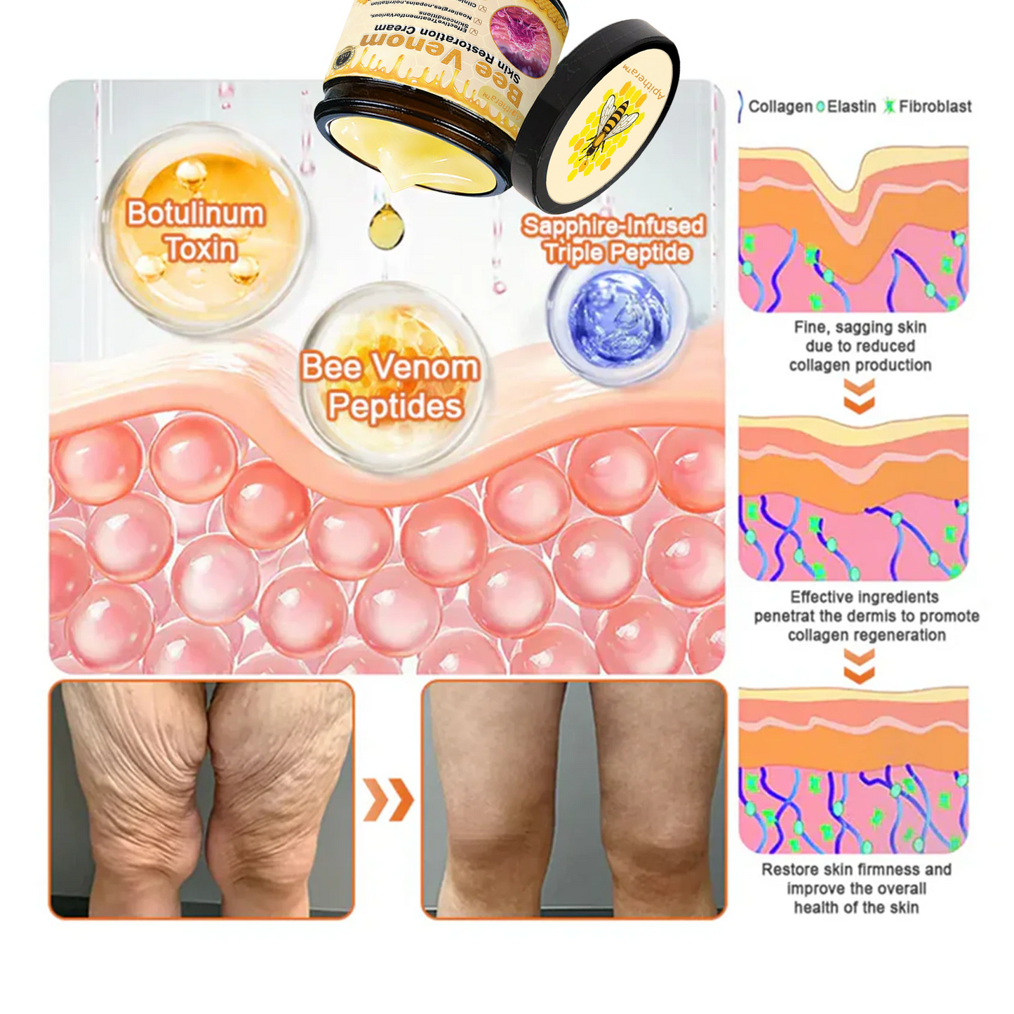 🔥Limited Time 60% OFF🔥🐝FDA Approved: Apithera™  Bee Venom Comprehensive Cream 🐝(Suitable for all ages & TGA recommends)