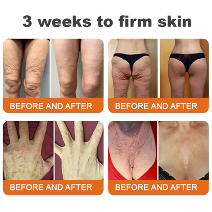 🔥Limited Time 60% OFF🔥🐝FDA Approved: Apithera™  Bee Venom Comprehensive Cream 🐝(Suitable for all ages & TGA recommends)