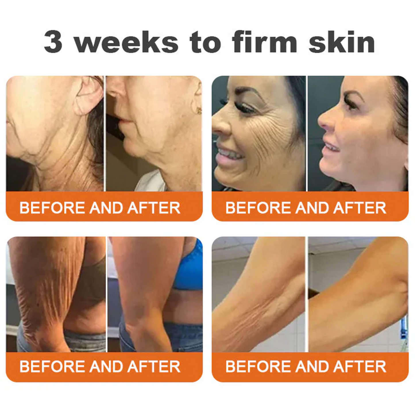🔥Limited Time 60% OFF🔥🐝FDA Approved: Apithera™  Bee Venom Comprehensive Cream 🐝(Suitable for all ages & TGA recommends)