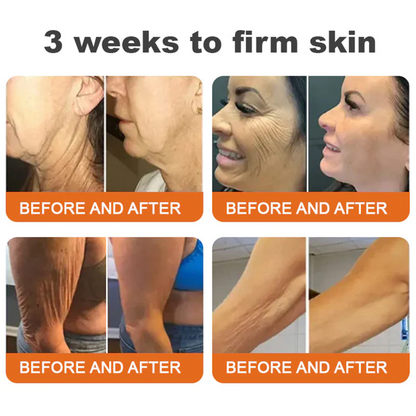 🔥Limited Time 60% OFF🔥🐝FDA Approved: Apithera™  Bee Venom Comprehensive Cream 🐝(Suitable for all ages & TGA recommends)